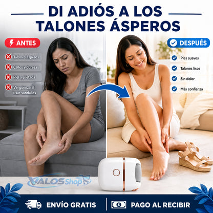 Removedor De Callos Eléctrico Recargable